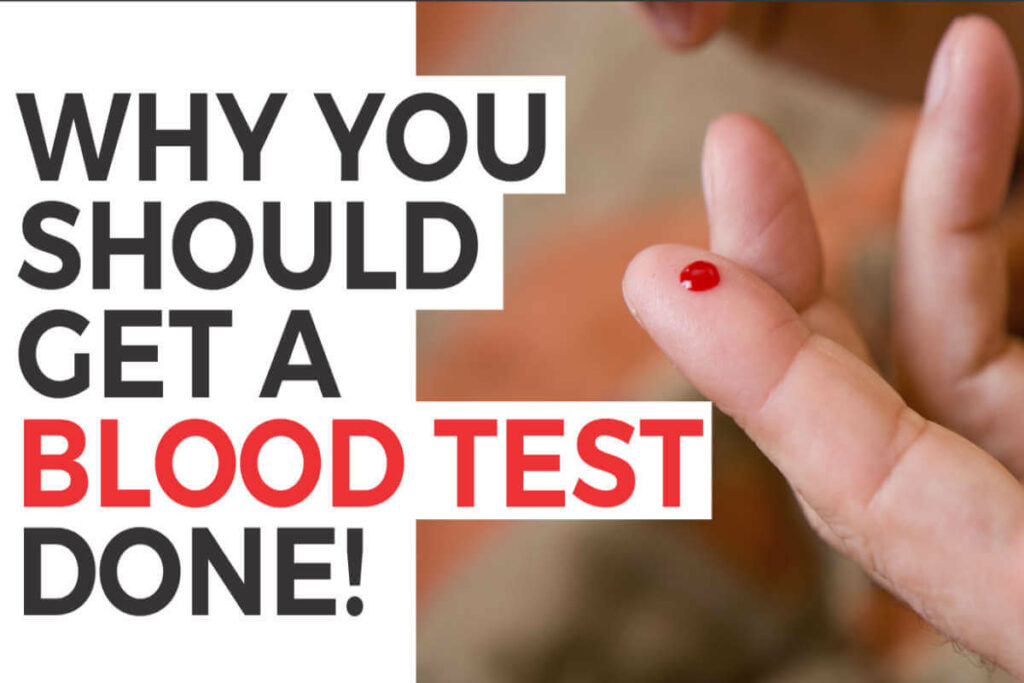What are the list of blood tests for weight loss?