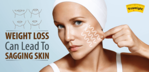 weight loss can lead to sagging skin